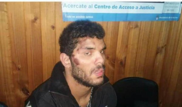 Bahía Blanca: Brutal ataque policial a un joven fiscal del Frente de Izquierda